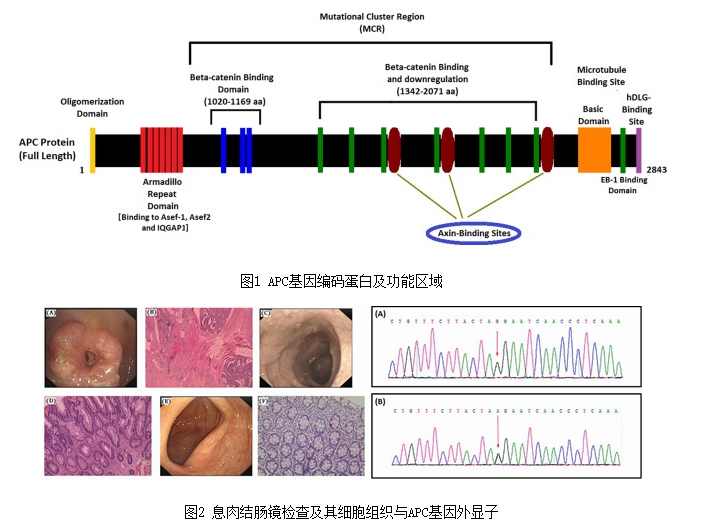 先进院在中国人群中基因胚系突变与家族性腺瘤性息肉病关系图谱研究领域取得新进展