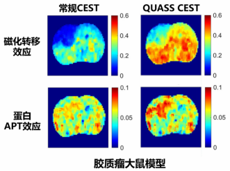 超灵敏磁共振化学交换饱和转移（CEST）成像技术研究取得重要进展