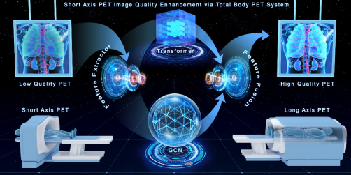 深圳先进院开发短轴PET/CT图像质量提升技术
