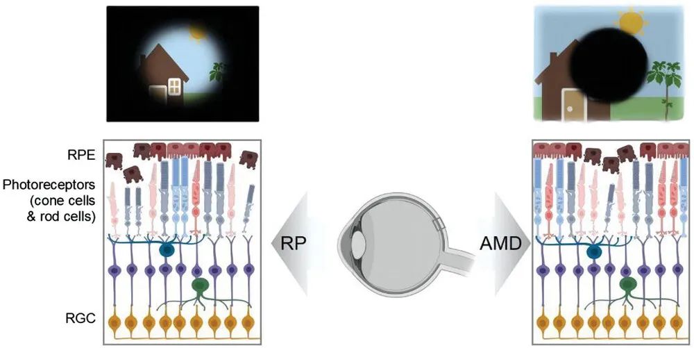 Advanced Functional Materials | 用于视觉修复的自适应界面材料与植入器件
